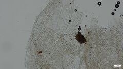 Agaricaceae