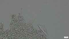 Basidiomycota