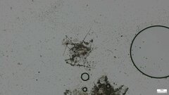 Chloridium gonytrichii