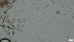 Chloridium gonytrichii
