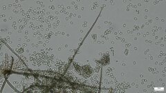 Chloridium gonytrichii