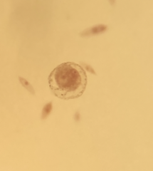 Chydorus