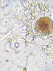 Staurastrum cerastes