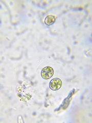 Chlorococcum