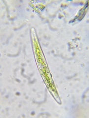 Closterium acerosum