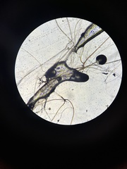 Rhizopus stolonifer