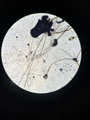 Rhizopus stolonifer