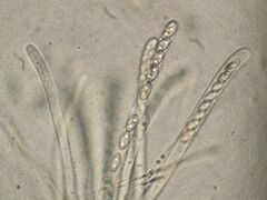 Sowerbyella imperialis