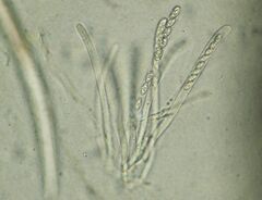 Sowerbyella imperialis