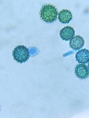 Hypomyces microspermus