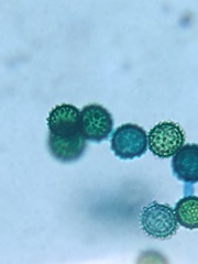 Hypomyces microspermus