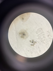 Chytridiomycota