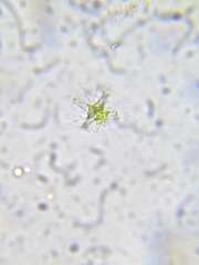 Staurastrum brachiatum