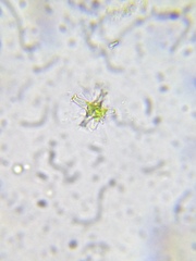 Staurastrum brachiatum