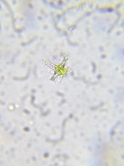 Staurastrum brachiatum