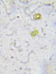 Staurastrum striolatum