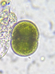 Cosmarium subcucumis