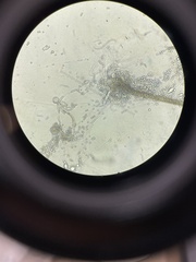 Rhizopus