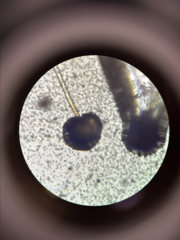 Aspergillus