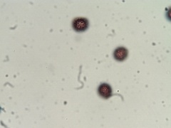 Strobilomyces confusus