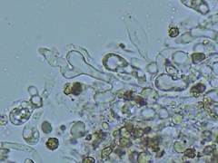 Tomentellopsis echinospora