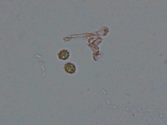 Tomentellopsis echinospora