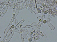 Tomentellopsis echinospora