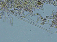 Tomentellopsis echinospora