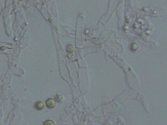 Tomentellopsis echinospora