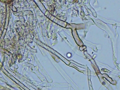 Tomentellopsis echinospora