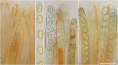 Peziza atrovinosa