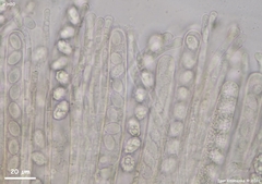 Peziza atrovinosa