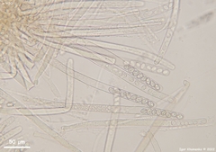 Peziza atrovinosa