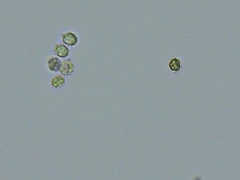 Tomentellopsis echinospora