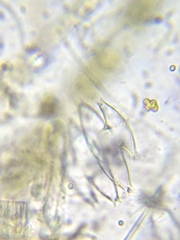 Micrasterias laticeps