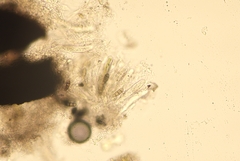 Hysterium angustatum