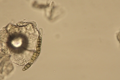 Hysterium angustatum