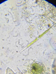 Closterium limneticum