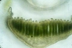 Polytrichastrum alpinum