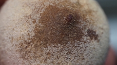Disholcaspis cinerosa