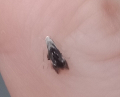 Thylacosceles radians