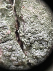 Pertusaria leioplaca