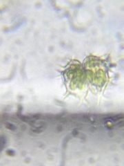 Xanthidium cristatum