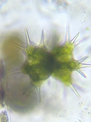 Staurastrum brasiliense