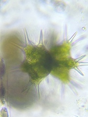 Staurastrum brasiliense