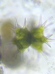 Staurastrum brasiliense