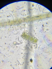 Euastrum abruptum