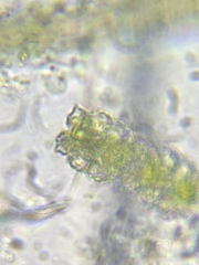 Euastrum abruptum