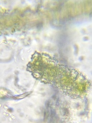 Euastrum abruptum