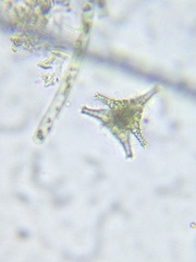 Staurastrum anatinum